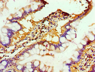 Immunohistochemistry of paraffin-embedded human kidney tissue using CAC10618 at dilution of 1:100