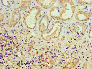 Alkbh2 Polyclonal Antibody - image 4