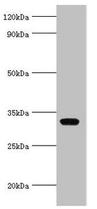 Immunohistochemistry of paraffin-embedded human kidney tissue using CAC10620 at dilution of 1:100