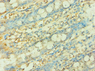Immunohistochemistry of paraffin-embedded human kidney tissue using CAC10621 at dilution of 1:100