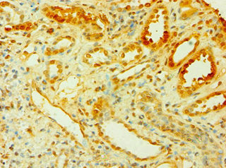 Cish Polyclonal Antibody - image 3