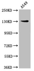 IHC image diluted at 1:121 and staining in paraffin-embedded human kidney tissue performed on a Leica BondTM system. After dewaxing and hydration, antigen retrieval was mediated by high pressure in a citrate buffer (pH 6.0). Section was blocked with 10% normal goat serum 30min at RT. Then primary antibody (1% BSA) was incubated at 4°C overnight. The primary is detected by a biotinylated secondary antibody and visualized using an HRP conjugated SP system.