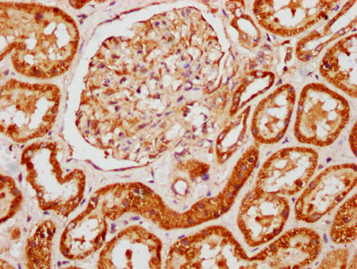 IHC image diluted at 1:121 and staining in paraffin-embedded human placenta tissue performed on a Leica BondTM system. After dewaxing and hydration, antigen retrieval was mediated by high pressure in a citrate buffer (pH 6.0). Section was blocked with 10% normal goat serum 30min at RT. Then primary antibody (1% BSA) was incubated at 4°C overnight. The primary is detected by a biotinylated secondary antibody and visualized using an HRP conjugated SP system.
