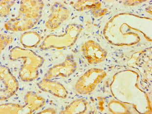 Immunofluorescent analysis of Hela cells using CAC10629 at dilution of 1:100 and Alexa Fluor 488-congugated AffiniPure Goat Anti-Rabbit IgG(H+L)