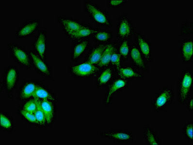 Mcph1 Polyclonal Antibody - image 3