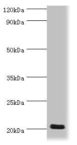 Immunohistochemistry of paraffin-embedded human testis tissue using CAC10632 at dilution of 1:100