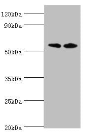 Immunohistochemistry of paraffin-embedded human placenta tissue using CAC10640 at dilution of 1:100