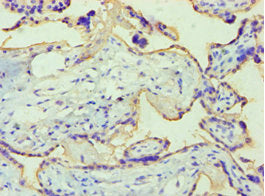 Alpp Polyclonal Antibody - image 3