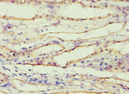 Akr1B10 Polyclonal Antibody - image 4