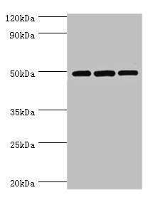 Immunohistochemistry of paraffin-embedded human small intestine tissue using CAC10648 at dilution of 1:100