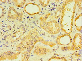 Dcp2 Polyclonal Antibody - image 4