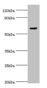 Immunohistochemistry of paraffin-embedded human colon cancer using CAC10654 at dilution of 1:100