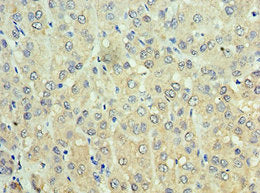 Adh1C Polyclonal Antibody - image 3