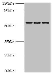 Immunohistochemistry of paraffin-embedded human breast cancer using CAC10669 at dilution of 1:100