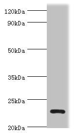 Immunohistochemistry of paraffin-embedded human ovarian cancer using CAC10685 at dilution of 1:100