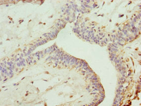 Immunohistochemistry of paraffin-embedded human brain tissue using CAC10702 at dilution of 1:100