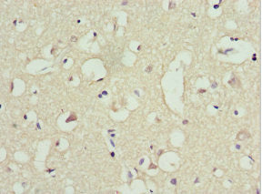 Trim13 Polyclonal Antibody - image 4