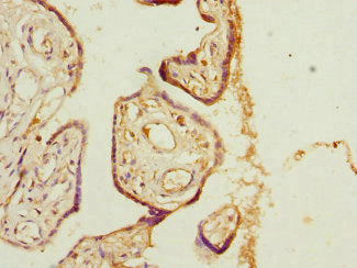Phlda2 Polyclonal Antibody - image 3