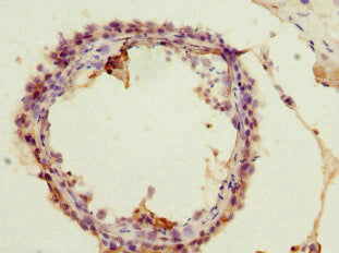 Acss2 Polyclonal Antibody - image 3