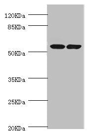 Immunohistochemistry of paraffin-embedded human kidney tissue using CAC10706 at dilution of 1:100