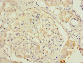 Immunofluorescent analysis of HepG2 cells using CAC10706 at dilution of 1:100 and Alexa Fluor 488-congugated AffiniPure Goat Anti-Rabbit IgG(H+L)