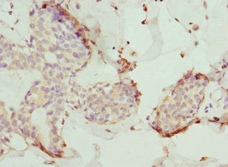 Tmod4 Polyclonal Antibody - image 4