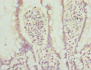 Immunohistochemistry of paraffin-embedded human skin tissue using CAC10713 at dilution of 1:100