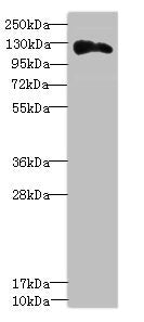 Immunohistochemistry of paraffin-embedded human brain tissue using CAC10714 at dilution of 1:100