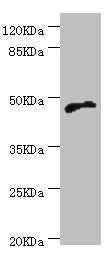 Immunohistochemistry of paraffin-embedded human ovarian cancer using CAC10724 at dilution of 1:100