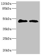 Immunohistochemistry of paraffin-embedded human breast cancer using CAC10734 at dilution of 1:100