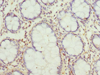 Gcnt2 Polyclonal Antibody - image 4