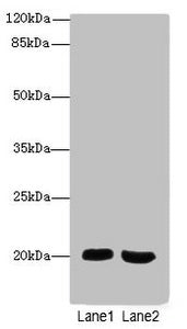 Immunohistochemistry of paraffin-embedded human colon cancer using CAC10738 at dilution of 1:100