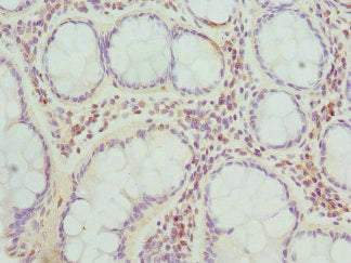 Immunohistochemistry of paraffin-embedded human brain tissue using CAC10739 at dilution of 1:100