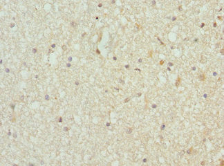 Immunoprecipitating TARS in A549 whole cell lysate; , Lane 1: Rabbit control IgG instead in A549 whole cell lysate. For western blotting, a HRP-conjugated Protein G antibody was used as the secondary antibody (1/2000); , Lane 2: CAC10739 (8µg) + A549 whole cell lysate (500µg); , Lane 3: A549 whole cell lysate (10µg)