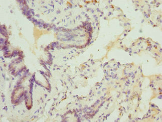 Immunohistochemistry of paraffin-embedded human testis tissue using CAC10743 at dilution of 1:100