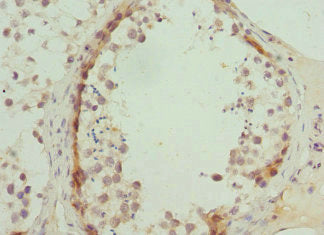 Abca3 Polyclonal Antibody - image 3