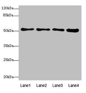 Immunohistochemistry of paraffin-embedded human pancreatic tissue using CAC10744 at dilution of 1:100
