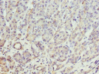 Btnl2 Polyclonal Antibody - image 3