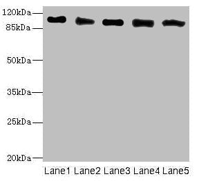Immunohistochemistry of paraffin-embedded human spleen tissue using CAC10747 at dilution of 1:100