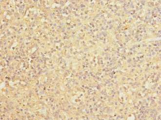 Immunohistochemistry of paraffin-embedded human placenta tissue using CAC10747 at dilution of 1:100
