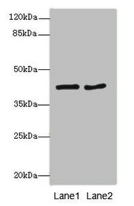 Immunohistochemistry of paraffin-embedded human liver tissue using CAC10755 at dilution of 1:100