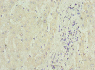 Immunohistochemistry of paraffin-embedded human brain tissue using CAC10755 at dilution of 1:100