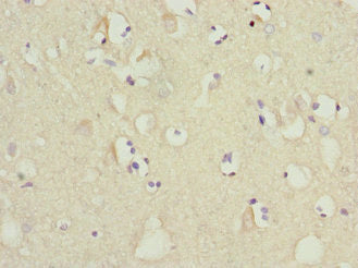 Mtch1 Polyclonal Antibody - image 4