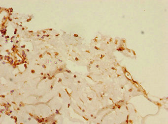 Blid Polyclonal Antibody - image 2