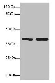 Immunohistochemistry of paraffin-embedded human colon cancer using CAC10761 at dilution of 1:100