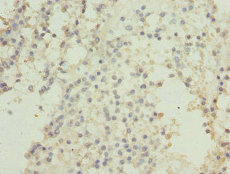 Immunoprecipitating CSNK1G2 in Hela whole cell lysate; , Lane 1: Rabbit control IgG instead of (1µg) instead in Hela whole cell lysate., For western blotting, a HRP-conjugated anti-rabbit IgG, specific to the non-reduced form of IgG was used the Secondary antibody (1/50000); , Lane 2: CAC10771 (4µg) + Hela whole cell lysate (500µg); , Lane 3: Hela whole cell lysate (20µg);