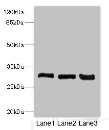 Immunohistochemistry of paraffin-embedded human liver tissue using CAC10774 at dilution of 1:100
