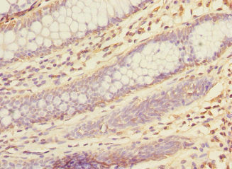 Immunoprecipitating KHK in Mouse liver tissue; , Lane 1: Rabbit control IgG instead in Mouse liver tissue., For western blotting, a HRP-conjugated Protein G antibody was used as the secondary antibody (1/2000); , Lane 2: CAC10774 (8µg) + Mouse liver tissue (500µg); , Lane 3: Mouse liver tissue (10µg);