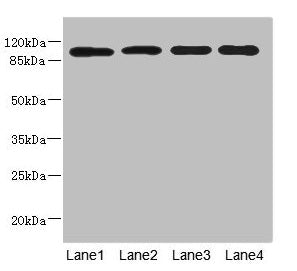 Immunohistochemistry of paraffin-embedded human liver tissue using CAC10779 at dilution of 1:100