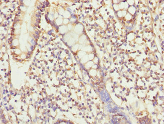 Usp26 Polyclonal Antibody - image 4